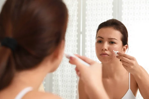 Menina Adolescente Com Problema Acne Aplicando Creme Perto Espelho Banheiro — Fotografia de Stock