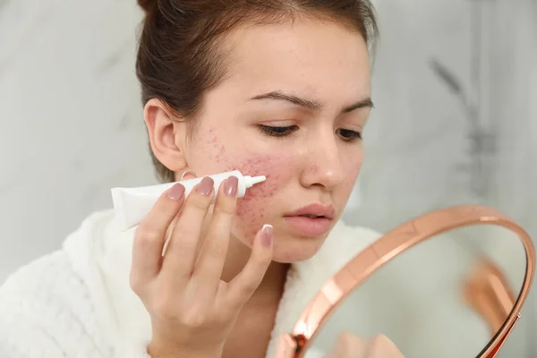 Teen Girl Acne Problem Applying Cream Using Mirror Bathroom — Stock Photo, Image