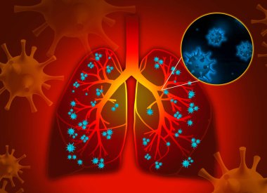 Kırmızı arka planda hastalıktan etkilenen insan akciğerleri tasviri