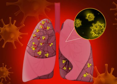 Kırmızı arka planda hastalıktan etkilenen insan akciğerleri tasviri