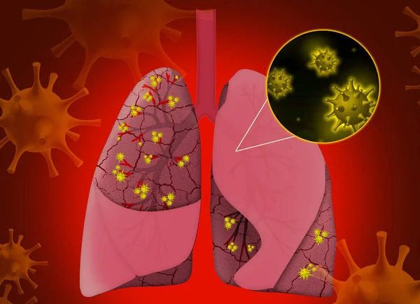 Illustration Human Lungs Affected Disease Red Background — Stock Photo, Image