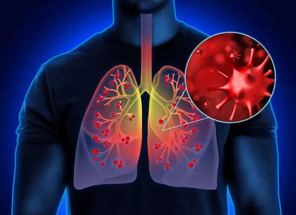 Man Diseased Lungs Dark Background Illustration — Stock Photo, Image