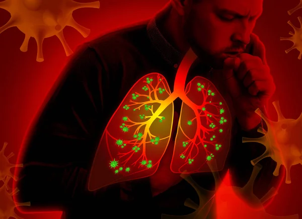 Man Diseased Lungs Coughing Red Background — Stock Photo, Image