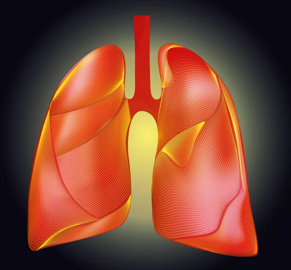 暗い背景に病気に罹患したヒト肺のイラスト — ストック写真