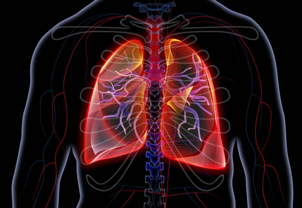 Man Diseased Lungs Black Background Illustration — Stock Photo, Image