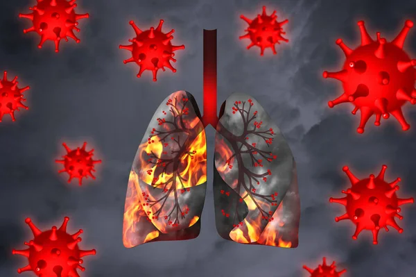Illustrazione Polmoni Umani Malati Circondati Virus Sfondo Grigio — Foto Stock