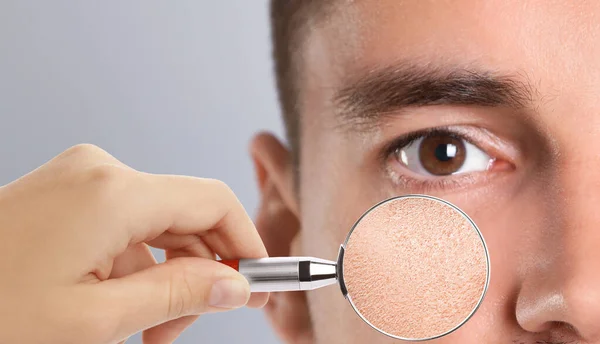 Man Dry Skin Visiting Dermatologist Closeup — Stock Photo, Image