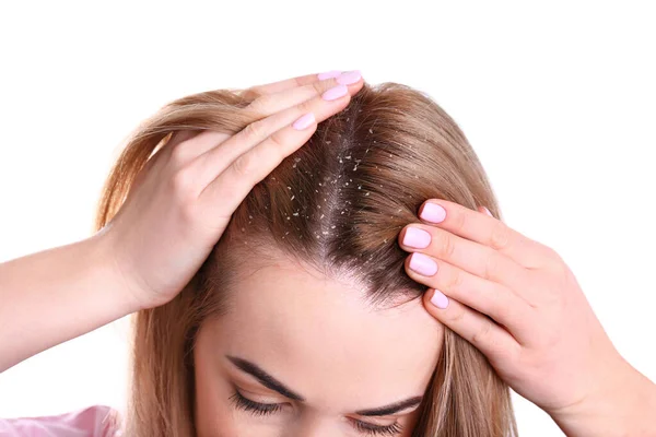 Woman Dandruff Her Hair White Background Closeup — Stock Photo, Image