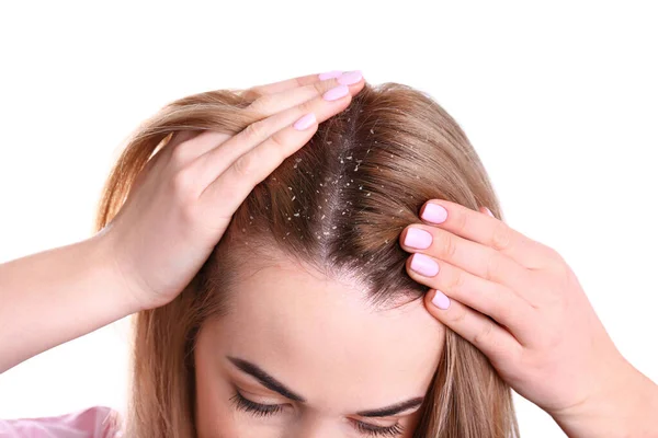 Frau Mit Schuppen Haar Auf Weißem Hintergrund Nahaufnahme — Stockfoto