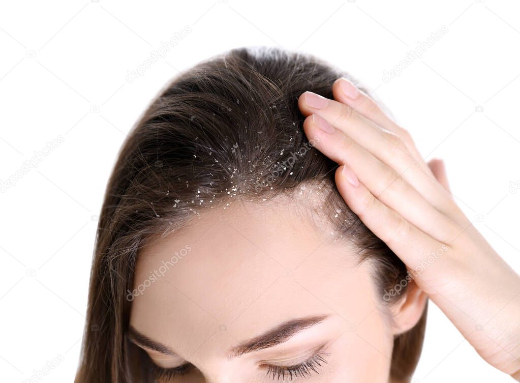 Woman with dandruff in her hair on white background, closeup