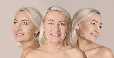 Yüzünde bej arkaplan ve kolaj izleri olan olgun bir kadının fotoğrafları. Estetik ameliyat