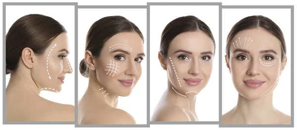 Photos Young Woman Lifting Marks Face White Background Collage Cosmetic — Stock Photo, Image