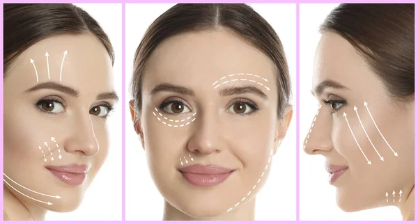 Photos Young Woman Lifting Marks Face White Background Collage Cosmetic — Stock Photo, Image