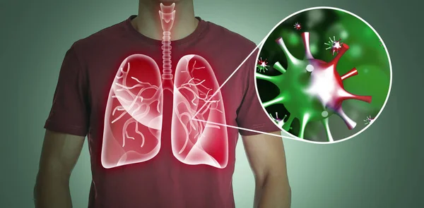 Man Diseased Lungs Dark Background — Stock Photo, Image