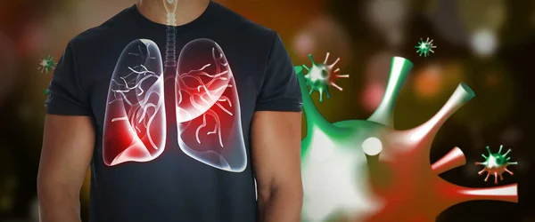 Man Diseased Lungs Surrounded Viruses Dark Background — Stock Photo, Image