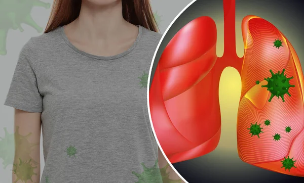 Woman Illustration Her Diseased Lungs — Stock Photo, Image