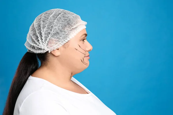 Жінка Подвійним Підборіддям Готова Операції Косметичної Хірургії Синьому Фоні — стокове фото