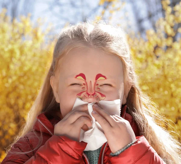 Niña Que Sufre Secreción Nasal Como Síntoma Alergia Aire Libre —  Fotos de Stock