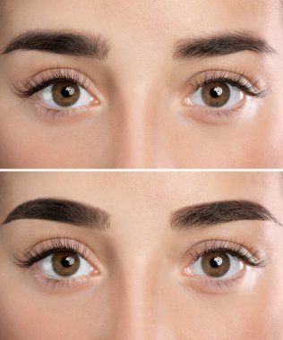 Önce ve sonra kaş düzeltmesi, yakın plan.