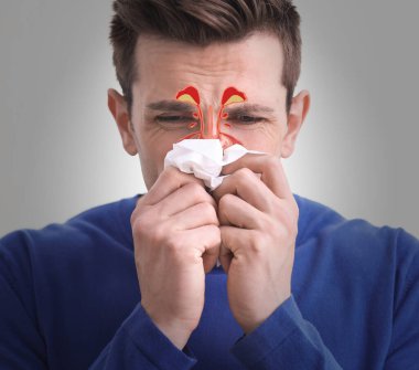 Man suffering from runny nose as allergy symptom. Sinuses illustration on face clipart