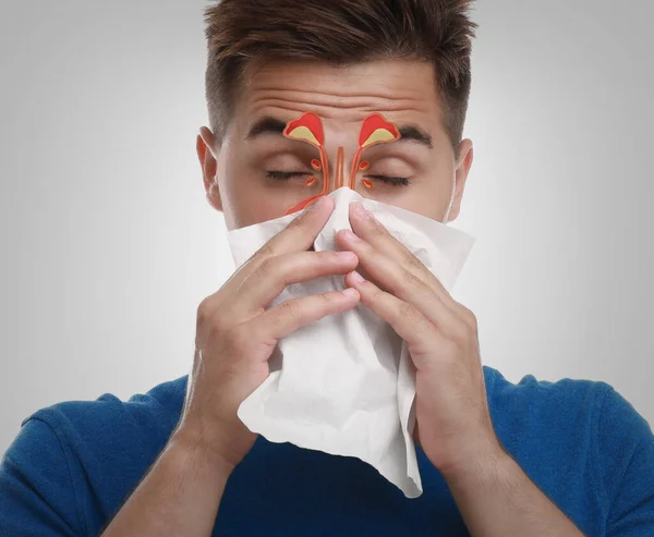 Hombre Que Sufre Secreción Nasal Como Síntoma Alergia Ilustración Senos —  Fotos de Stock