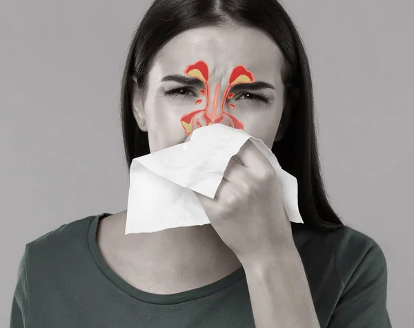 Mujer Que Sufre Secreción Nasal Como Síntoma Alergia Ilustración Senos — Foto de Stock