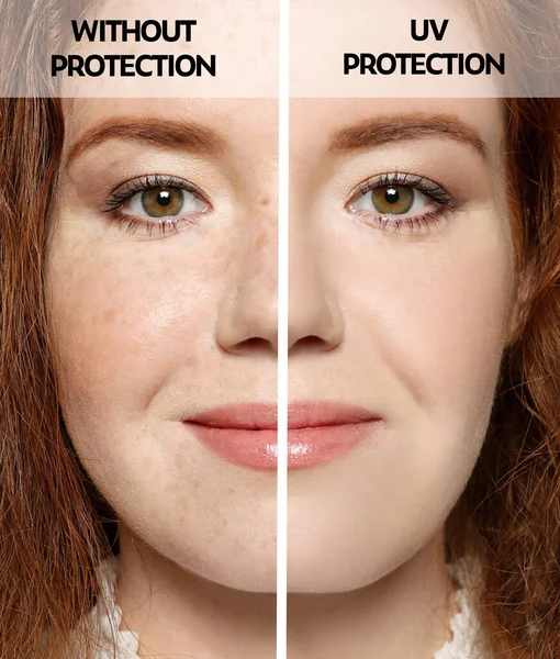 Mujer Joven Sin Con Crema Protección Solar Cara Primer Plano — Foto de Stock