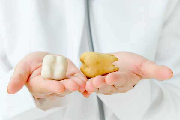 dentist holding molar