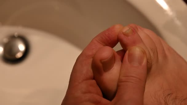 Image Gros Plan Ongle Sur Pied Droit Homme Caucasien Les — Video