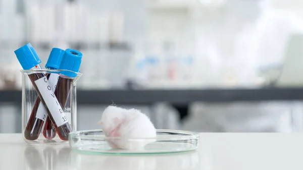 Tabung Pengumpulan Darah Dari Pasien Hidup Atas Meja Laboratorium Putih — Stok Foto