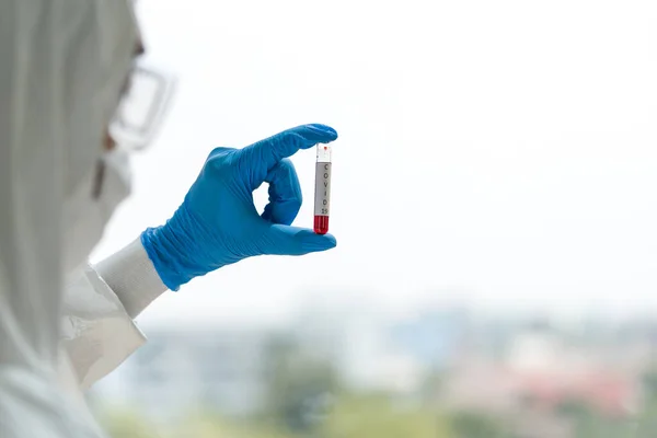 Peneliti Epidemiologi Dalam Pakaian Protektif Virus Melihat Sampel Darah Pasien — Stok Foto