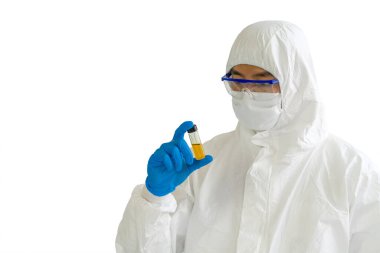 Epidemiyolojik araştırmacılar rastgele cam şişedeki sarı kimyasala bakıyorlar. Coronavirus hastalığı 2019. Laboratuvarda test süreci. (kırpma yolu)