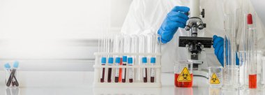Araştırmacılar mikrop kapmış insanların kan örneklerine bakmak için mikroskop kullanıyorlar.