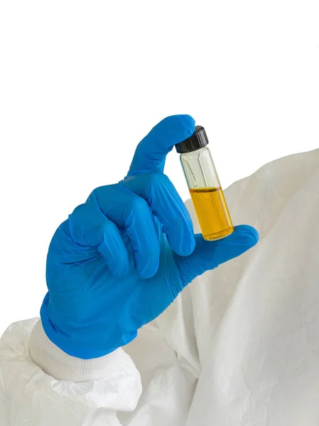 Segelas Botol Berisi Bahan Kimia Kuning Tangan Para Peneliti Proses — Stok Foto