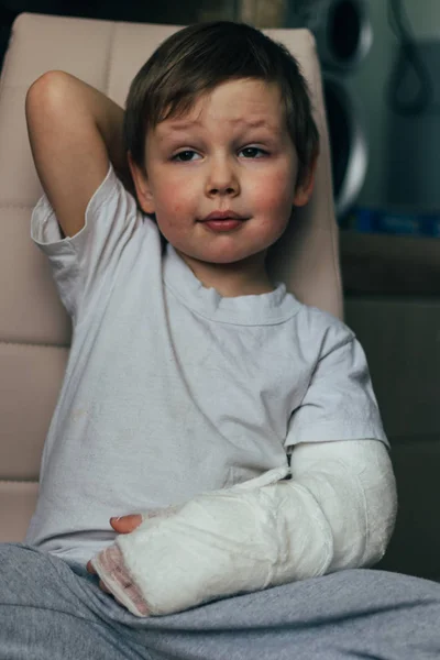 Um menino pequeno está sentado em uma cadeira com um braço quebrado, em um molde. Hospital. medicina. Perigo. dor. para quebrar membros. violência . — Fotografia de Stock