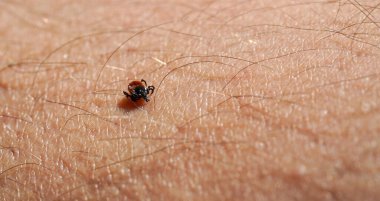 İnsan derisinde sürünen küçük kene Ixodes ricinus.