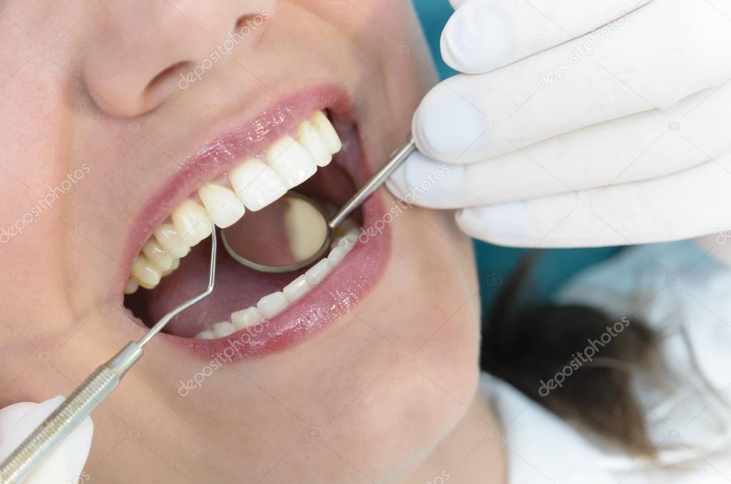 Woman Getting Dental Consultation