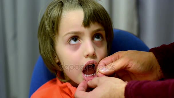 Extraction rudimentaire des dents — Video