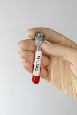 Wuhan, Çin 'den yeni Corona virüsü enfeksiyonu Covid-19' un teşhisi için yapılan kan testleri. Bulaşıcı salgın konsepti.