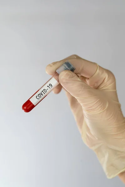 Laboratoryjna próbka krwi do diagnozy nowego zakażenia wirusem Corona Covid-19 z Wuhan w Chinach. Koncepcja zakażenia pandemią. — Zdjęcie stockowe