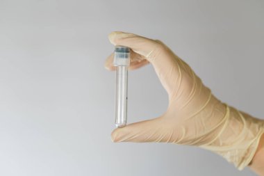 Bir hemşirenin elinde biyomateryal analizi için boş test tüpü. İhtiyati tedbirlerle klinik virüs analizi.