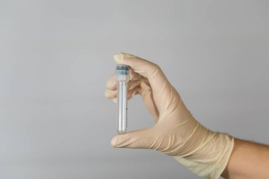 Bir hemşirenin elinde biyomateryal analizi için boş test tüpü. İhtiyati tedbirlerle klinik virüs analizi.