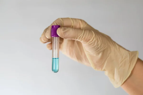 Üzerinde mavi şeffaf kimyasal sıvı bulunan test tüpü bir bilim adamının ellerinde. Lateks eldivenli eller. Süpürge test tüpü.