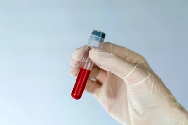 Test tube with a blood sample in the hands of a nurse. Blood test for viruses in the clinic with the observance of precautions.