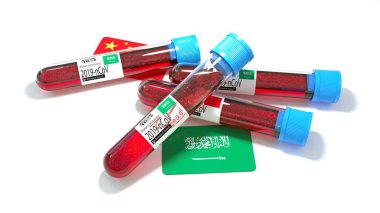 Suudi Arabistan Krallığı ulusal bayrağı 3D wuhan 2019-ncov virüs biyolojik test tüpü. 3B illüstrasyon