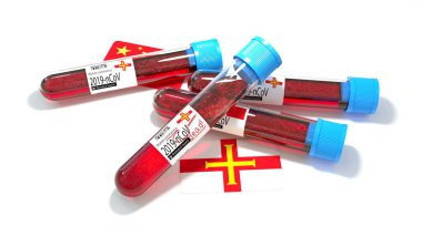Guernsey Ulusal Bayrağı 3D wuhan 2019-ncov virüs biyoloji test tüpü. 3B illüstrasyon