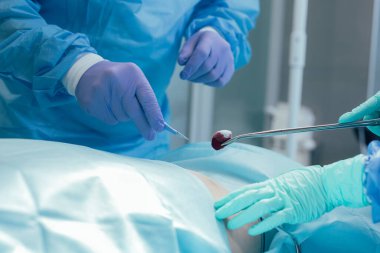 Neşter tutan deneyimli bir cerrah ve kanlı pamuklu bir hemşire.