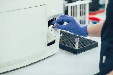 Kauçuk eldivenli bir elin, üzerinde kan örneği olan bir test tüpünü tutup hematoloji analizcisine koyması.