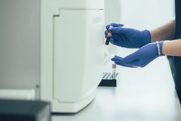 Foto Recortada Las Manos Con Guantes Goma Colocando Cuidadosamente Tubo — Foto de Stock