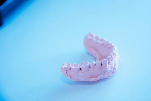Moldes dentários de dentes humanos — Fotografia de Stock